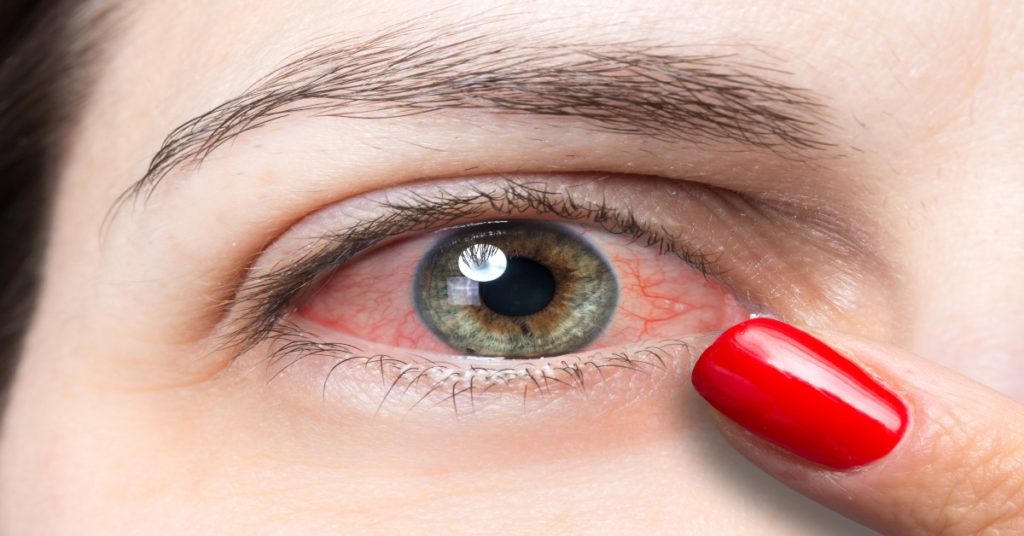 Retinopatia diabetică- vas de sânge spart la ochi, cauze și tratament, Sibiu