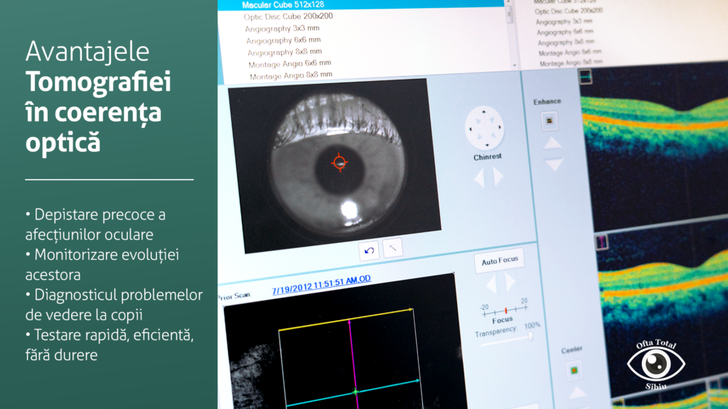 tomografie-coerenta-optica
